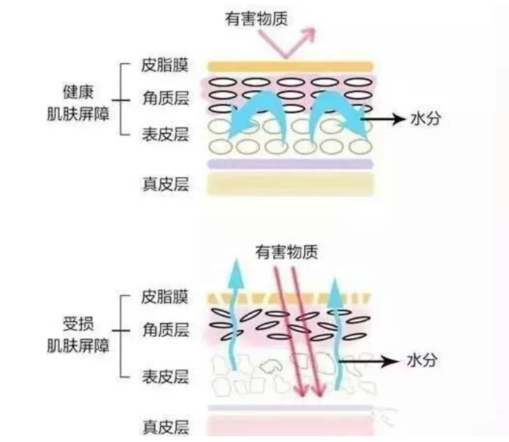 干、癢、紅、腫？別慌涂護膚品，先看看皮膚屏